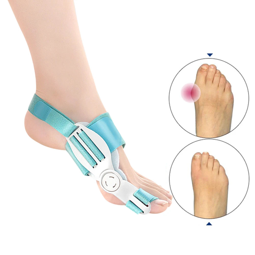 Correcteur d’Orteils – Attelle Orthopédique pour Hallux Valgus, Oignons et Orteils Croisés