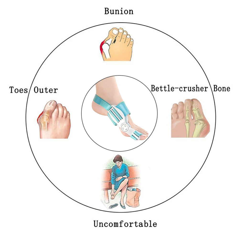 Correcteur d’Orteils – Attelle Orthopédique pour Hallux Valgus, Oignons et Orteils Croisés
