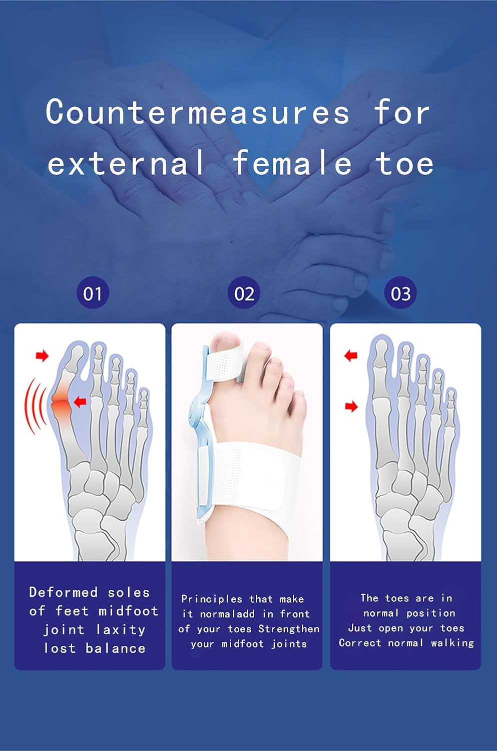 Correcteur d’Orteils – Attelle Orthopédique pour Hallux Valgus, Oignons et Orteils Croisés
