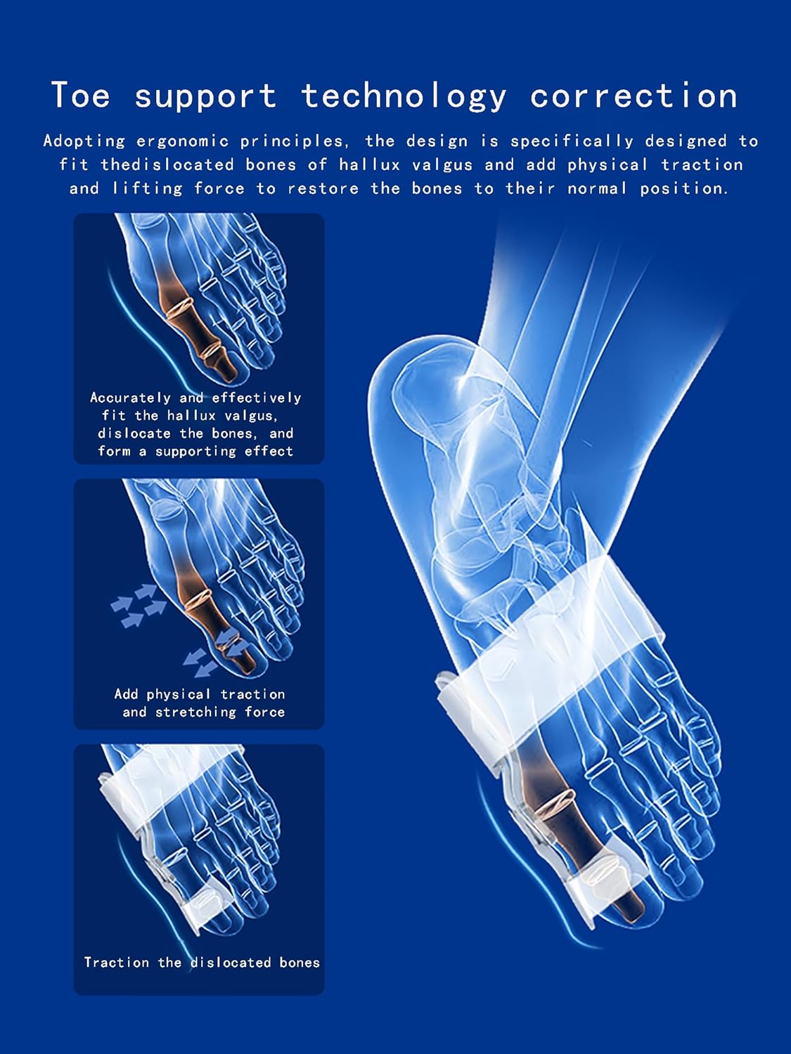 Correcteur d’Orteils – Attelle Orthopédique pour Hallux Valgus, Oignons et Orteils Croisés